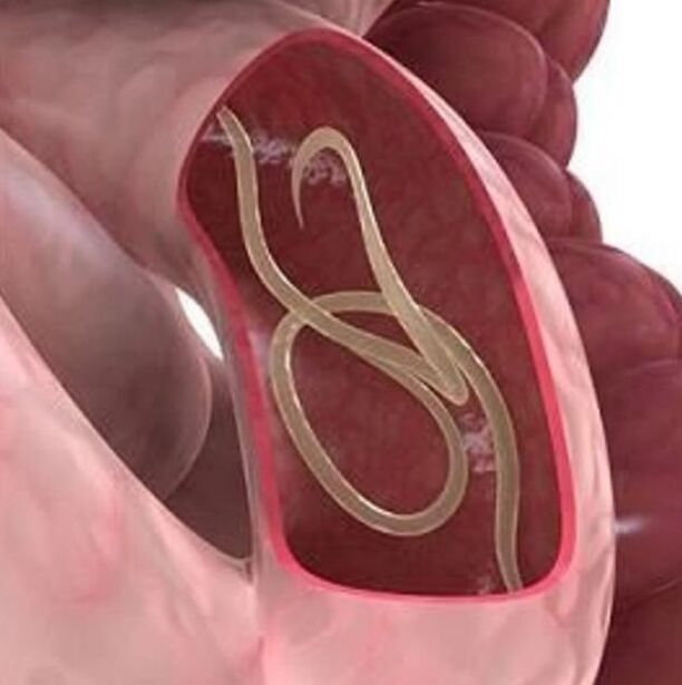 Zizareen seinaleak traktu gastrointestinalean